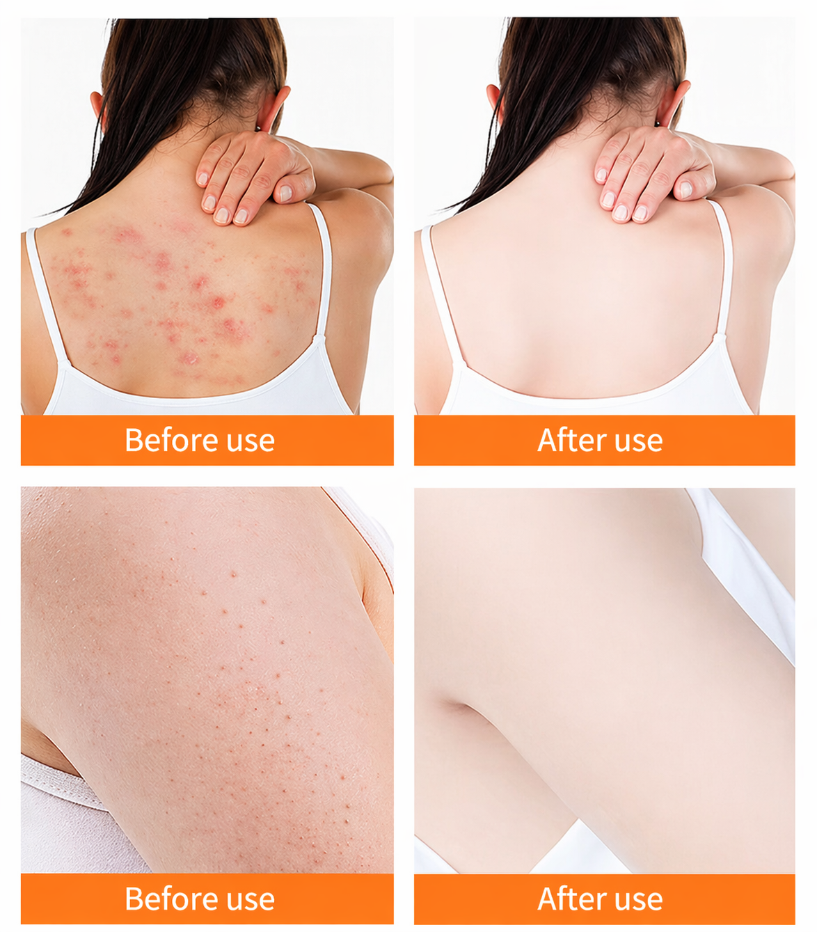 Turmeric Scrub – Skin Care Scrub for Deep Cleansing & Glowing Skin (150g)