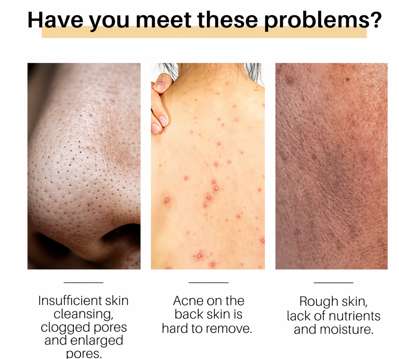 Turmeric Soap – Deep Cleansing Soap for Glowing Skin & Pore Reduction (100g)