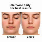 Cyperus Rotundus Post-Removal Body Oil – 60ml
