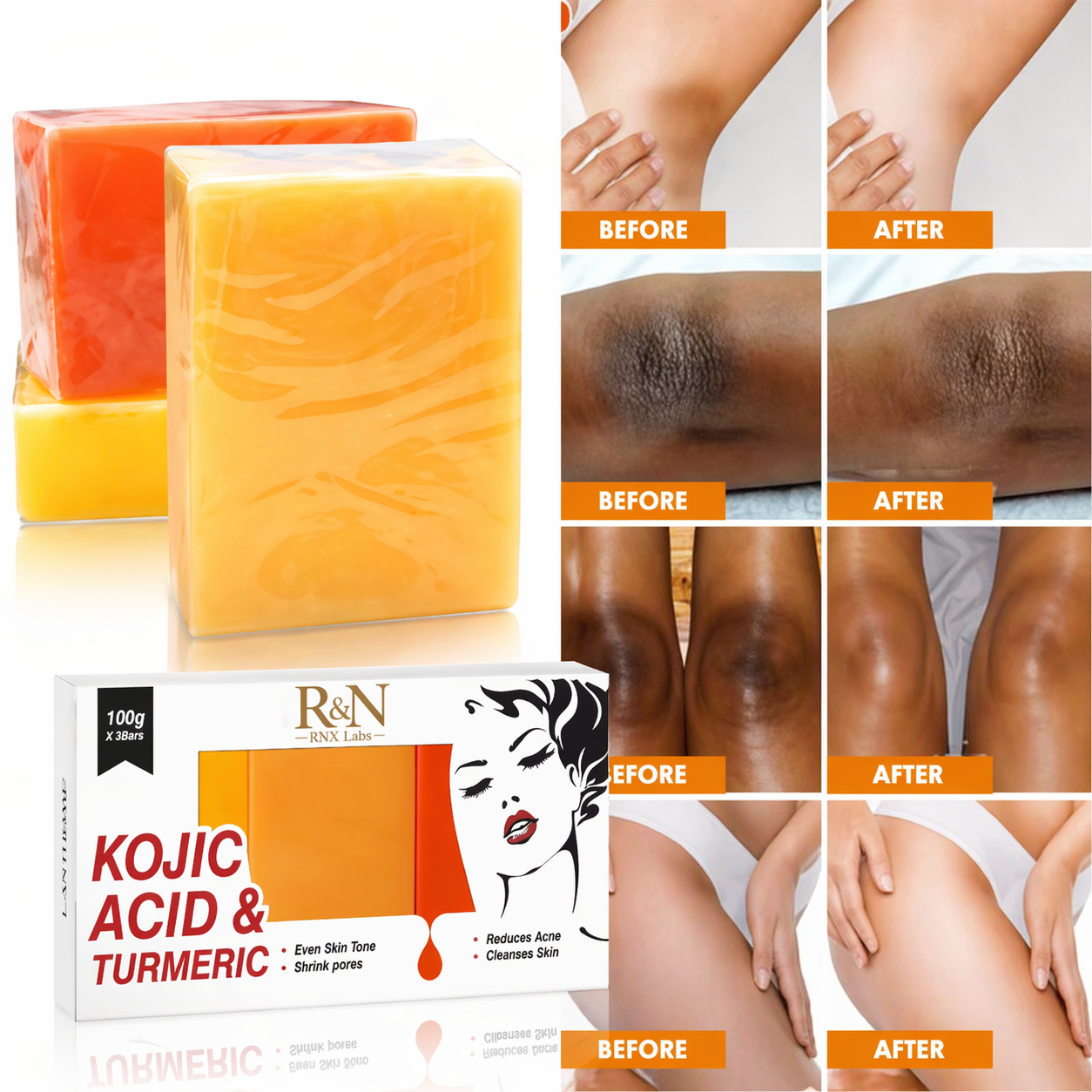 Kojic Acid &amp; Turmeric Soap – Brightening Soap for Even Skin Tone &amp; Smooth Texture (100g x 3 Bars)