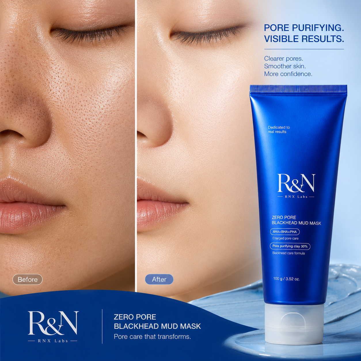 ZERO PORE BLACKHEAD MUD MASK – Deep Pore Purifying