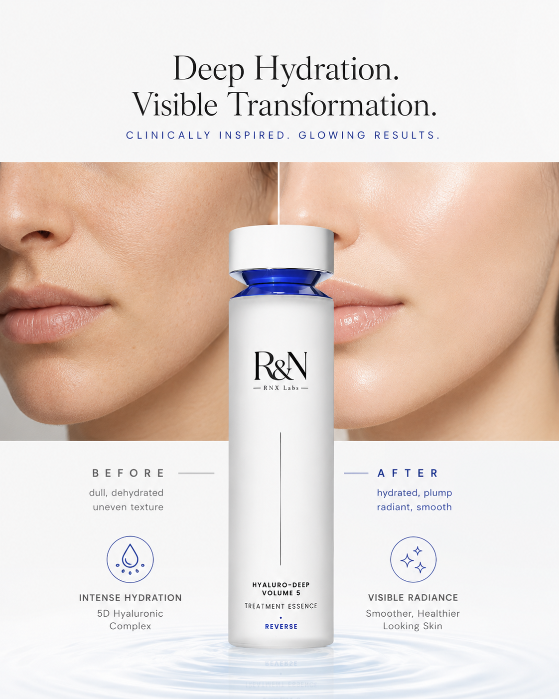RNX Labs Hyaluro-Deep Volume 5 Treatment Essence – REVERSE