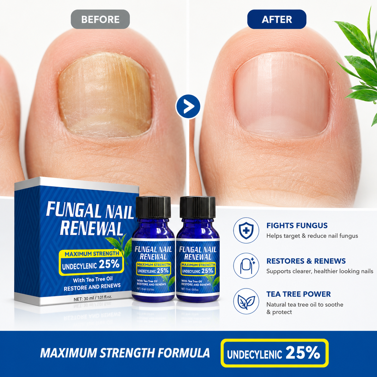 Undecylenic 25% Fungal Nail Renewal Oil with Tea Tree Oil 30ml