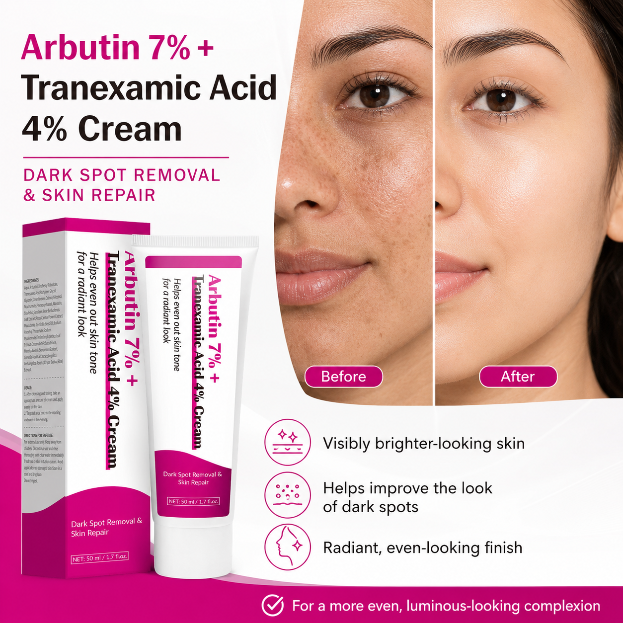Arbutin 7% + Tranexamic Acid 4% Tone Care Cream 50ml